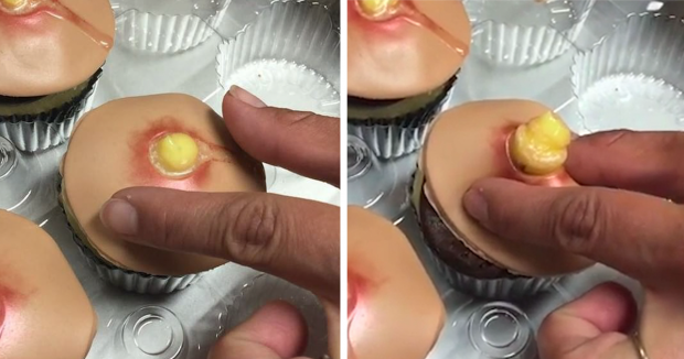 pimple-cupcakes-dr-pimple-popper-blessed-by-baking-fb